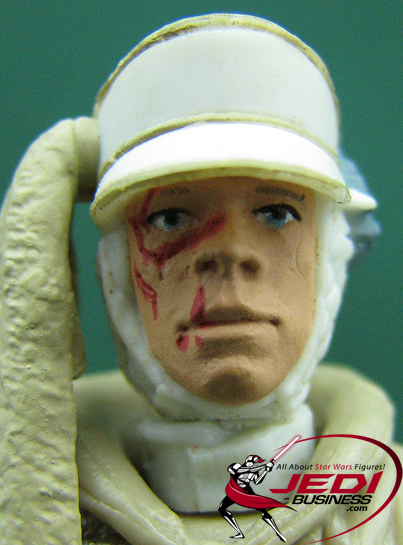 Luke Skywalker Hoth Attack Star Wars SAGA Series